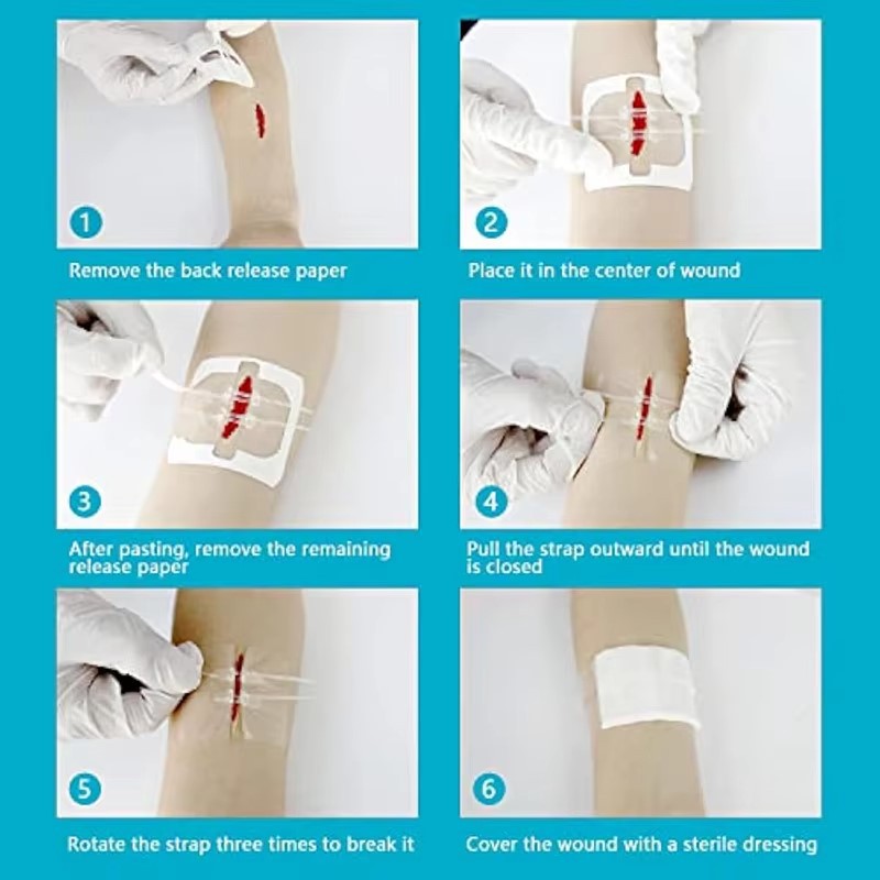 Band Aid Butterfly Bandage Supplier Band Aid Butterfly Bandage Supplier